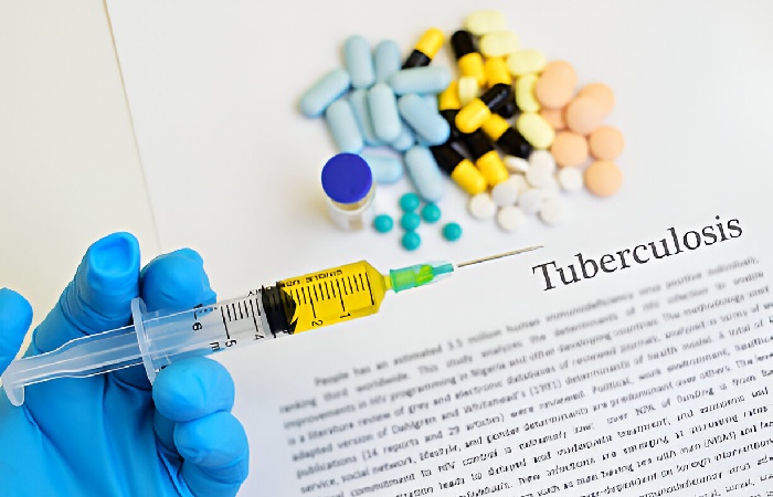 What's a TB Test Anyway?